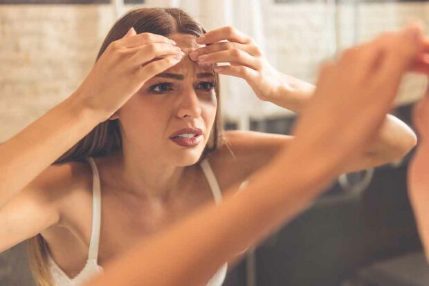 5 Reasons Why Your Pimples Wouldn't Leave